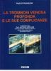 La trombosi venosa profonda e le sue complicanze