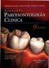 Carranza. Parodontologia clinica