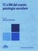 TC e RM del cranio: patologia vascolare
