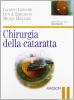 Chirurgia della cataratta
