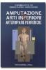 Amputazione degli arti inferiori nelle arteriopatie periferiche