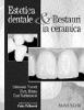 Estetica dentale e restauri in ceramica