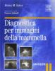 Diagnostica per immagini della mammella