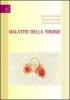 Malattie delle tiroide
