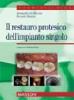 Il restauro protesico dell'impianto singolo