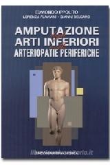 Amputazione degli arti inferiori nelle arteriopatie periferiche Amputazione degli arti inferiori nelle arteriopatie periferiche