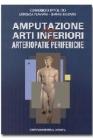 Amputazione degli arti inferiori nelle arteriopatie periferiche