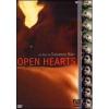 Open Hearts